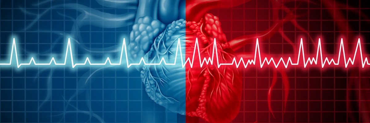 Aritmi (Kalp Ritim Bozukluğu)