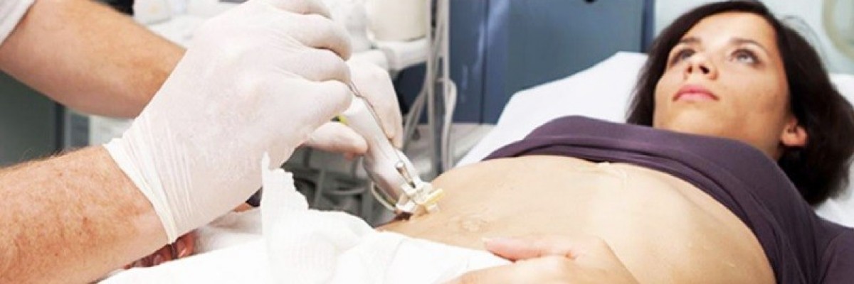 Gebelikte tarama testleri nelerdir?