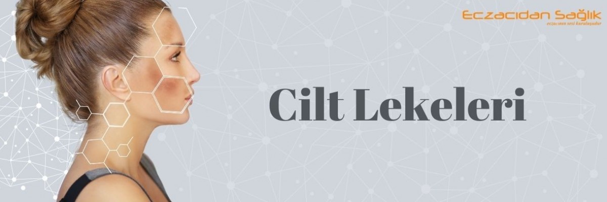 Cilt Lekeleri