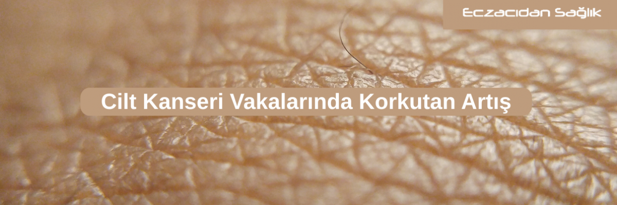 Cilt Kanseri Vakalarında Korkutan Artış