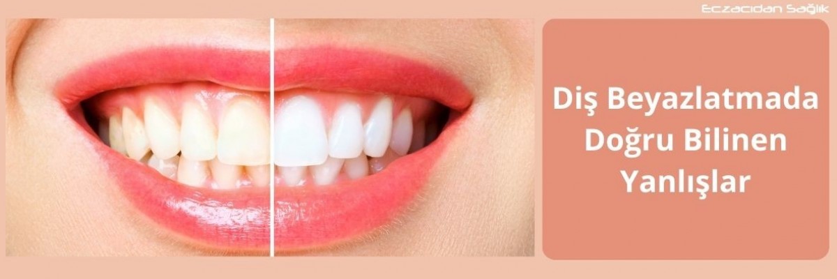 Diş Beyazlatmada Doğru Bilinen Yanlışlar