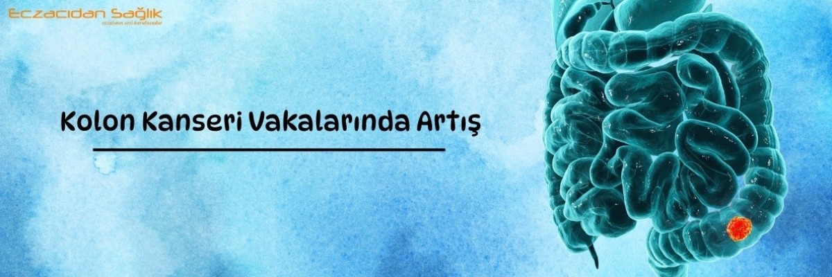 Kolon Kanseri Vakalarında Artış