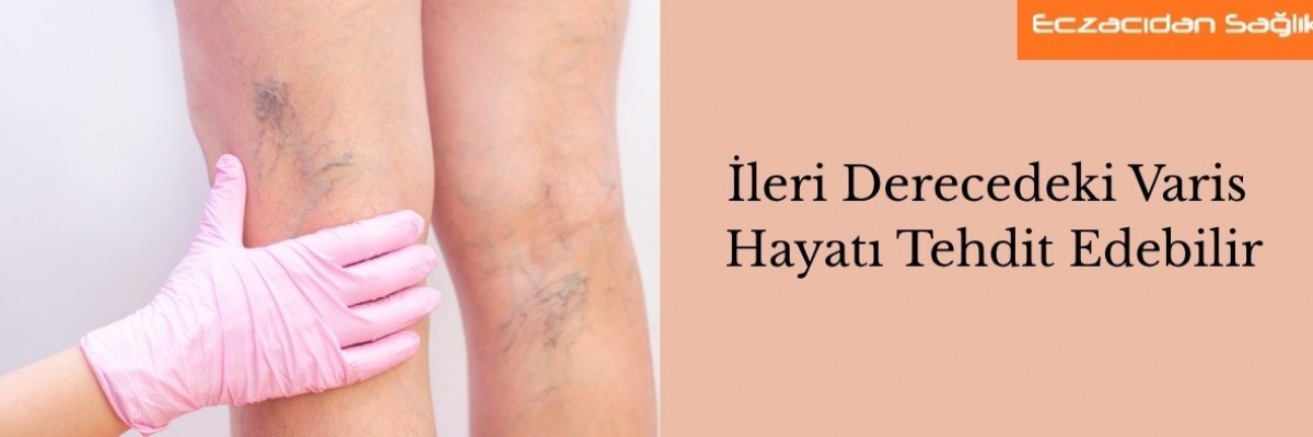 İleri Derecedeki Varis Hayatı Tehdit Edebilir